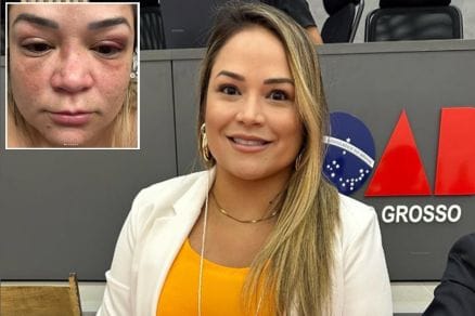 Advogada presa por agressão diz que também foi atacada por irmãs e divulga fotos de lesões