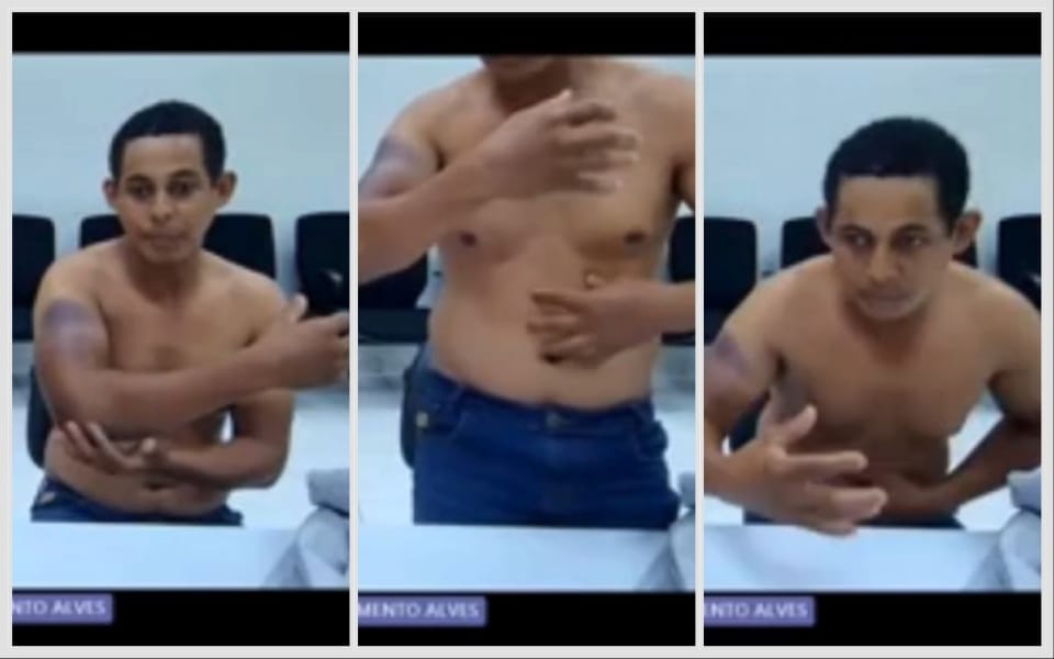 Bandido preso por assalto a banco em MT alega ter sido torturado por policiais da GCCO