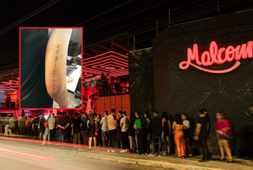 Juiz condena Malcom Pub a pagar R$ 40 mil a cliente agredido por seguranças
