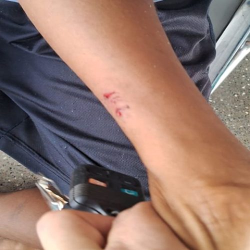 Trivelato: Cachorro solto ataca adolescente e provoca ferimentos