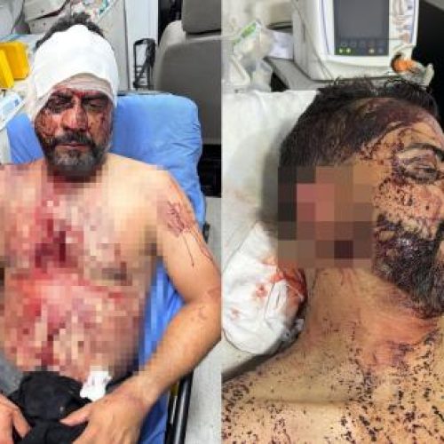 VIOLÊNCIA: Bandidos exigem R$ 1 milhão, cortam orelha de vereador e ameaçam arrancar braço do filho