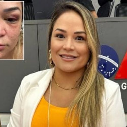 Advogada presa por agressão diz que também foi atacada por irmãs e divulga fotos de lesões