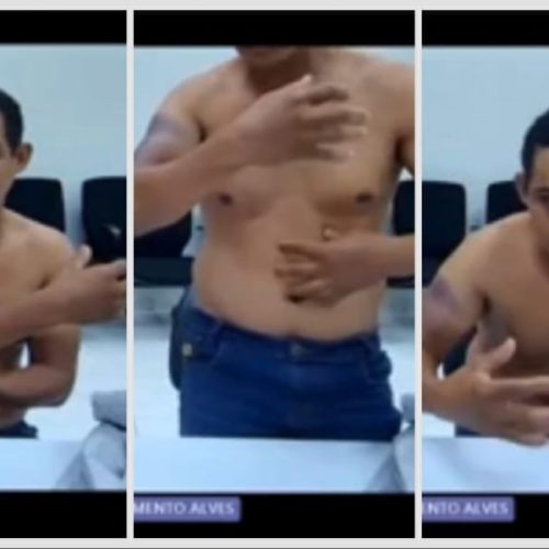 Bandido preso por assalto a banco em MT alega ter sido torturado por policiais da GCCO