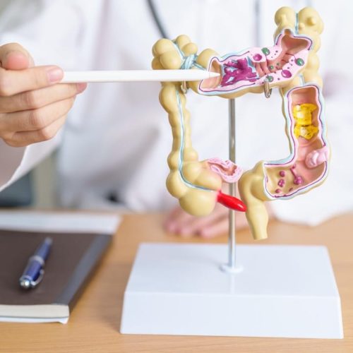 Diagnóstico precoce aumenta chance de cura de Câncer de intestino