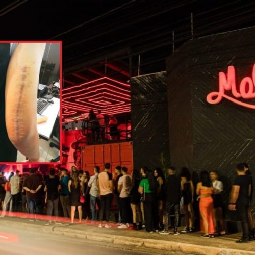 Juiz condena Malcom Pub a pagar R$ 40 mil a cliente agredido por seguranças