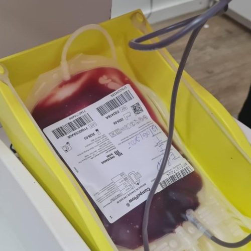 MT Hemocentro atende mais de 500 pacientes com a doença falciforme