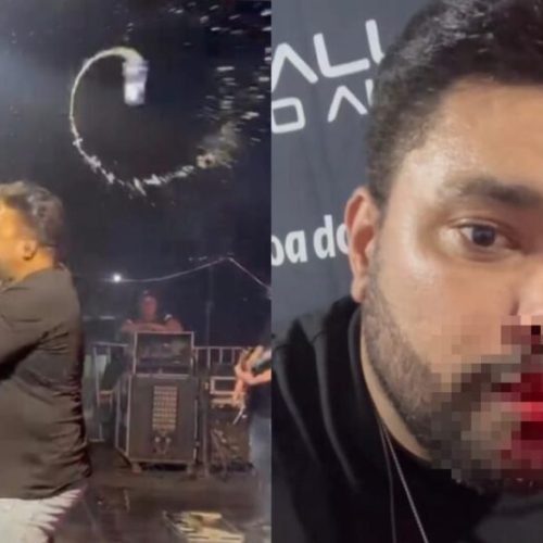 LUCIARA- MT: Cantor de forró é atacado e ferido com lata de cerveja durante show em MT